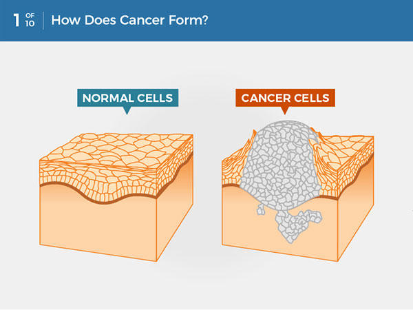 Ung thư hình thành như thế nào? Ung thư là một căn bệnh gây ra khi các tế bào phân chia không kiểm soát được và lây lan sang các mô xung quanh.