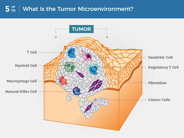 Vi môi trường khối u là gì? Trong một khối u, các tế bào ung thư được bao quanh bởi nhiều loại tế bào miễn dịch, nguyên bào sợi, phân tử và mạch máu — cái được gọi là vi môi trường khối u. Tế bào ung thư có thể thay đổi vi môi trường, do đó có thể ảnh hưởng đến cách ung thư phát triển và lây lan.