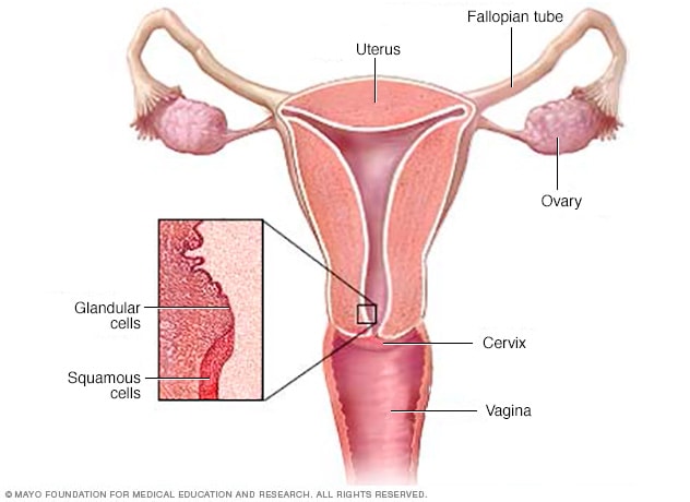 Ung thư cổ tử cung là gì? Những điều phụ nữ nên biết